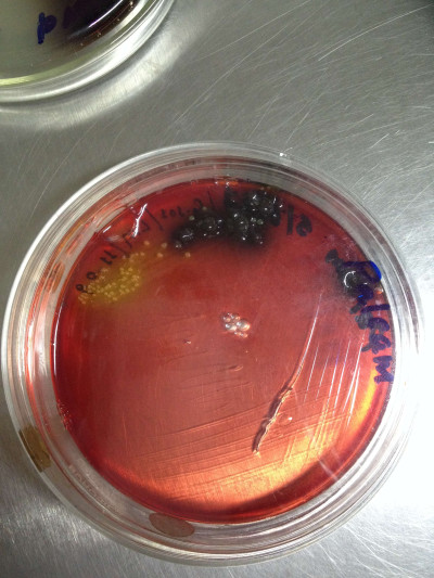 Colonies of Listeria Monocytogenes Contaminated with Staphylococcus