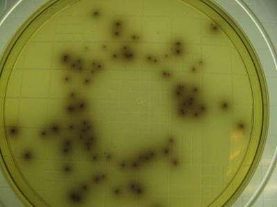 <em>Listeria monocytogenes</em> Grown on Listeria Selective Agar