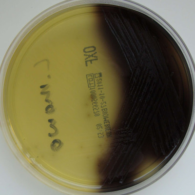 Listeria monocytogenes - Oxford Listeria Agar