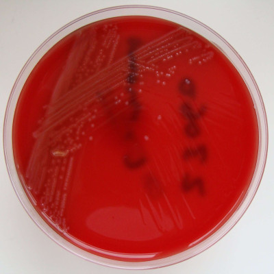 Listeria monocytogenes - Columbia Horse Blood Agar