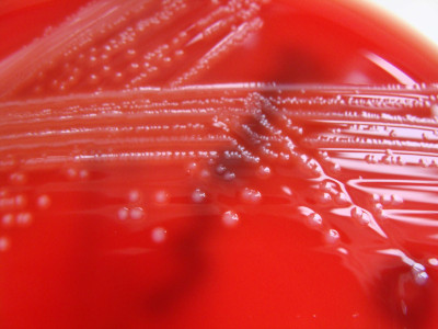 Listeria Monocytogenes - Columbia Horse Blood Agar