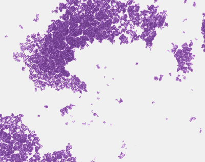 Corynebacterium glutamicum