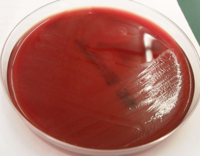 Clostridium perfringens