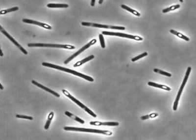 Clostridium perfringens sporulating