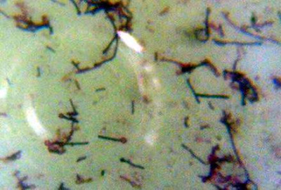 Gram Stain of Clostridium tetani