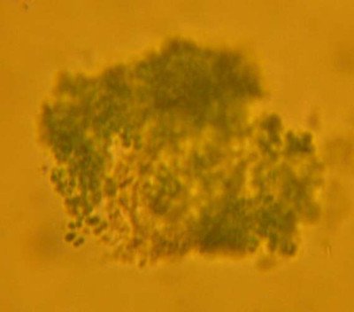 Microcystis Live