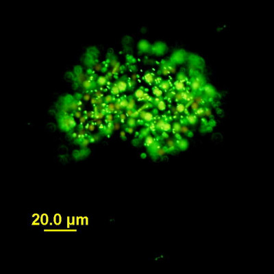 Microcystis in Sytox