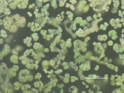 Algae, Microcystis (8741972050)