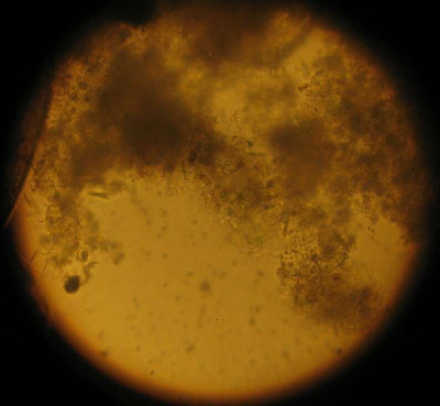 Microcystis Bloom