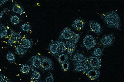 Lung Cells Infection by Pseudomonas aeruginosa