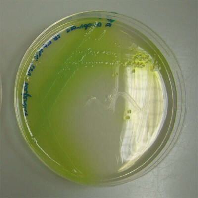 Pseudomonas aeruginosa Pigment