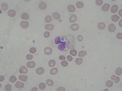 Pseudomonas aeruginosa Smear