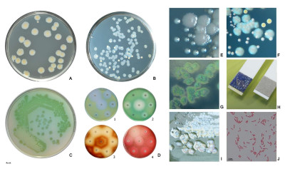 Pseudomonas aeruginosa Pigment Production