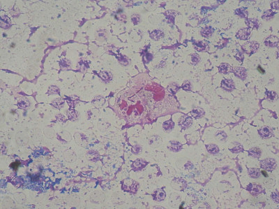 Pseudomonas aeruginosa smear Gram 2010-02-10