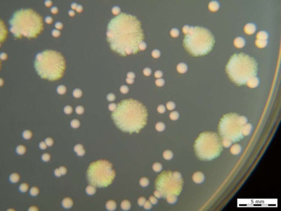 Pseudomonas aeruginosa and Enterococcus faecalis on TSA