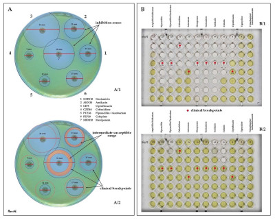 Pseudomonas aeruginosa Antibiotic Susceptibility Testing