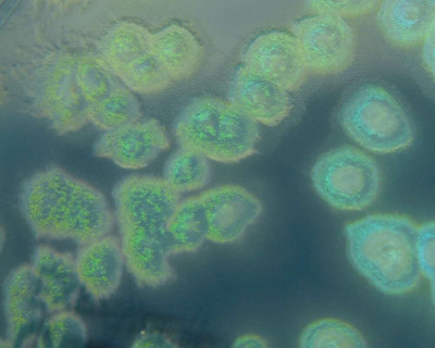 Pseudomonas aeruginosa on Cetrimide Agar