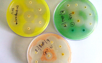 Pseudomonas pigments