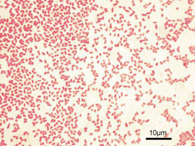 Pseudomonas aeruginosa Gram