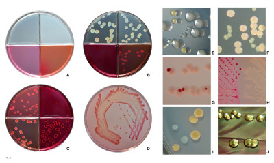 Escherichia coli on Growing on Various Agar Media