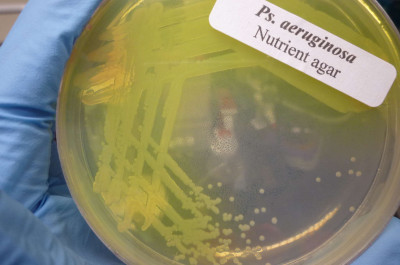 Pseudomonas aeruginosa Culture