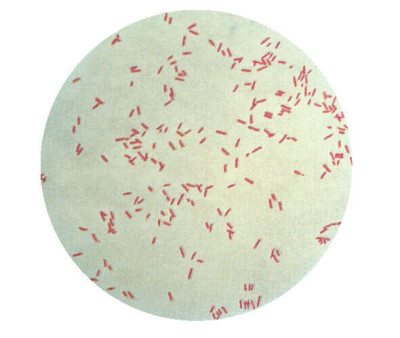 Pseudomonas aeruginosa gram