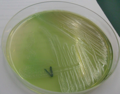 Pseudomonasaeruginosa