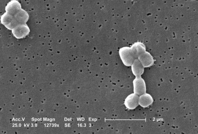 Acinetobacter baumannii, SEM, 9330 lores