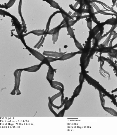 Mariprofundus ferrooxydans PV-1 Stalks TEM Image