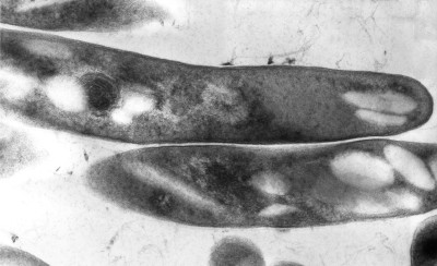 Mycobacterium tuberculosis