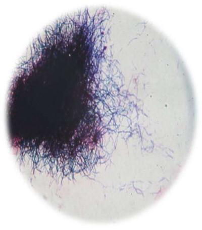 Actinomycete