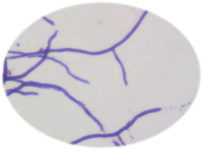 Actinomycet