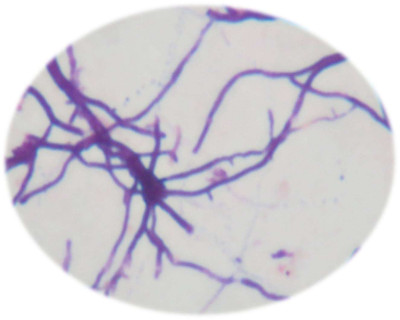 Shape of actinomycet