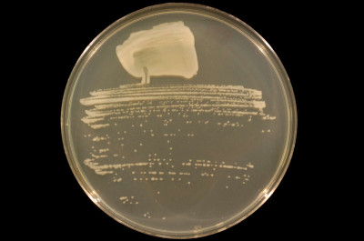 Sinorhizobium Strain NGR234 on TY Agar