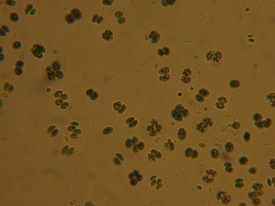 Chroococcus