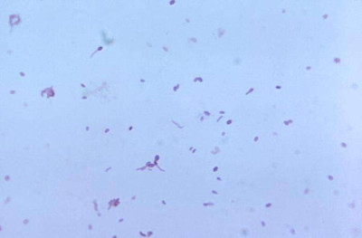 Clostridium tertium