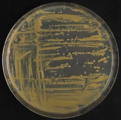 Colonies de Xanthomonas campestris pv. vitians sur milieu TSA 1-10eme