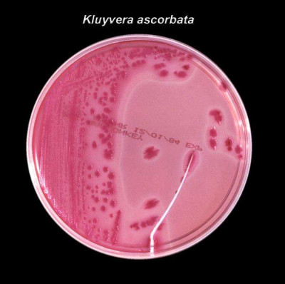 Kluyvera ascorbata Bacteria Culture Plate