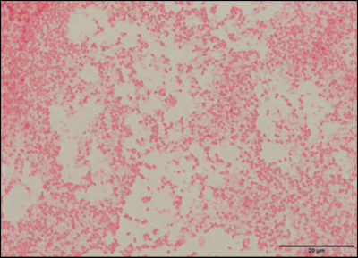 Pseudescherichia vulneris Gram Stain