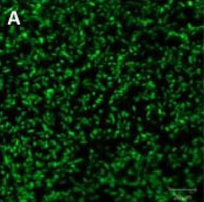 Photorhabdus luminescens