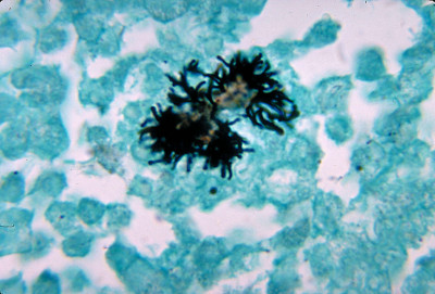 Actinomyces naeslundii 01