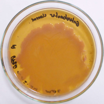 Enterobacter cloacae MacConkey colonies 93