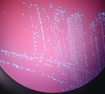 Aerococcus urinae - colonies