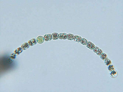 Anabaena circinalis