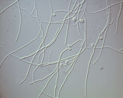 Hypha and Vesicle of Franikia