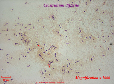 Clostridium difficile