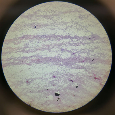 Clostridi Bacteria Gram Coloration