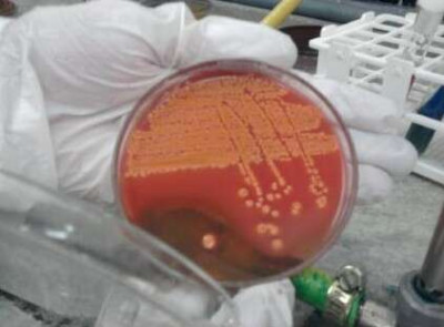 Desarrollo de Enterobacterias fermentadoras de Lactosa en HEA