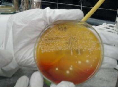 Desarrollo de Enterobacterias fermentadoras de Lactosa en XLD.jpeg