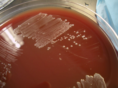 Snodgrassella alvi blood agar Kwong